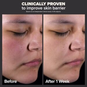 Paula’s Choice Skin Perfecting 2% BHA Liquid Exfoliant