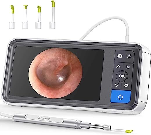 Anykit 3.9mm Digital Otoscope