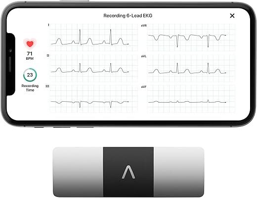 AliveCor KardiaMobile 6-Lead EKG Monitor – Instant Results